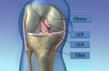 joelho-cruzado